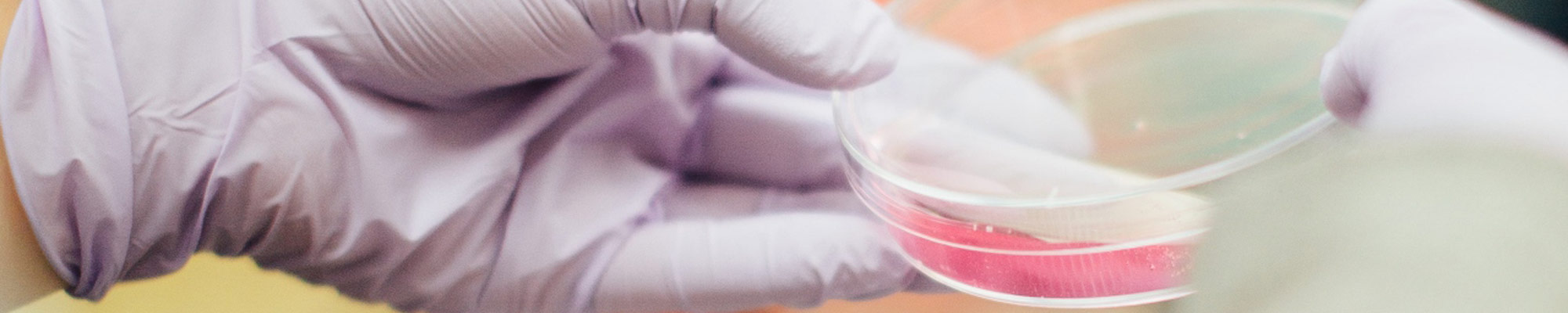 Scientist holding Petri dish