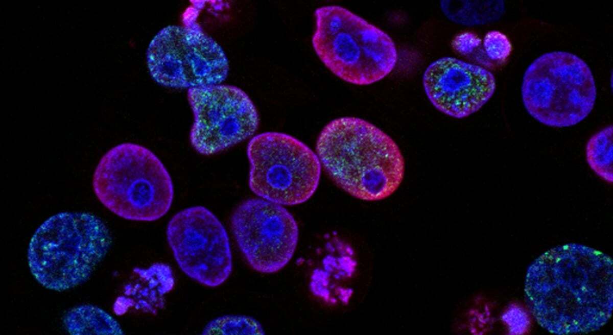 Maven VCTs invest in £13.5m funding round for Laverock Therapeutics